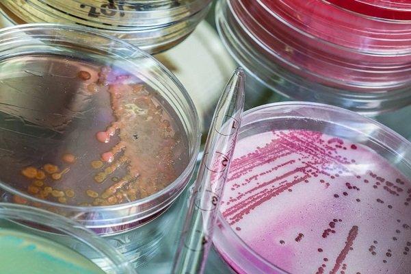 آشنایی با شیوه جدید نابودی باکتری های مقاوم به درمان